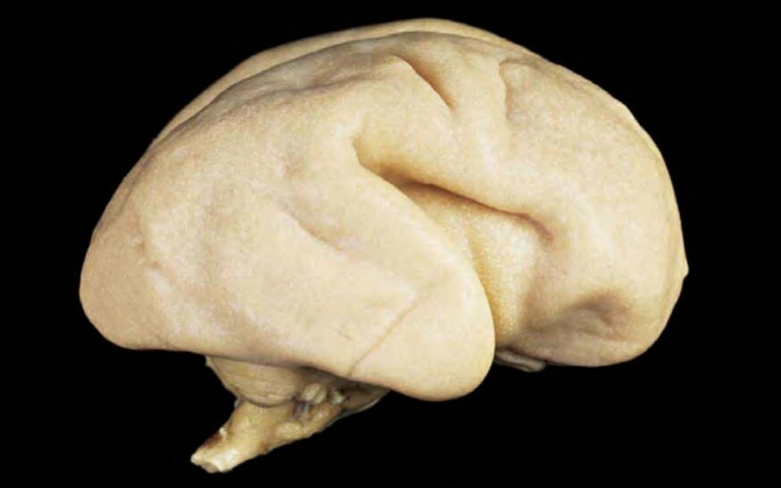 A fetal brain at 24 weeks, with spinal cord at left, has yet to develop characteristic cerebral folding.