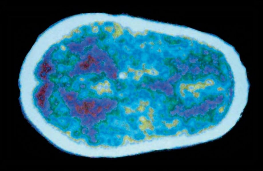 A newborn’s brain (seen above in an MRI) is ready to begin making, remaking, and pruning neural connections by the million.